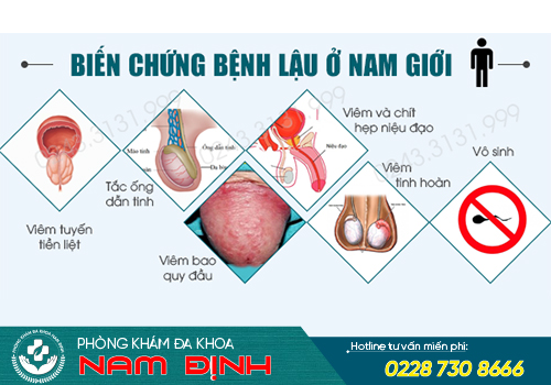 biểu hiện bệnh lậu