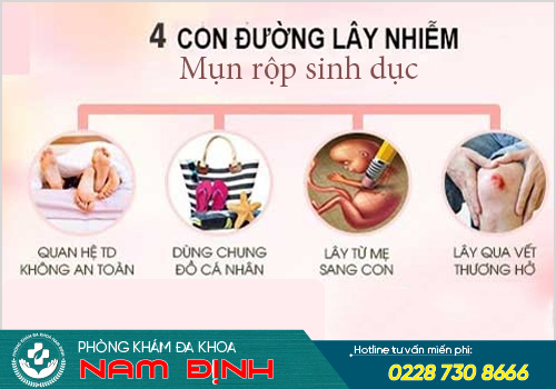 mụn rộp sinh dục nam