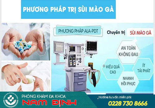 sùi mào gà dương vật
